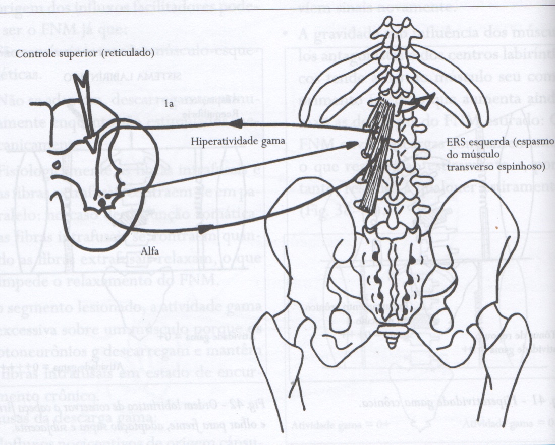 A hiperatividade gama e consequentes espasmo muscular e disfunção vertebral.