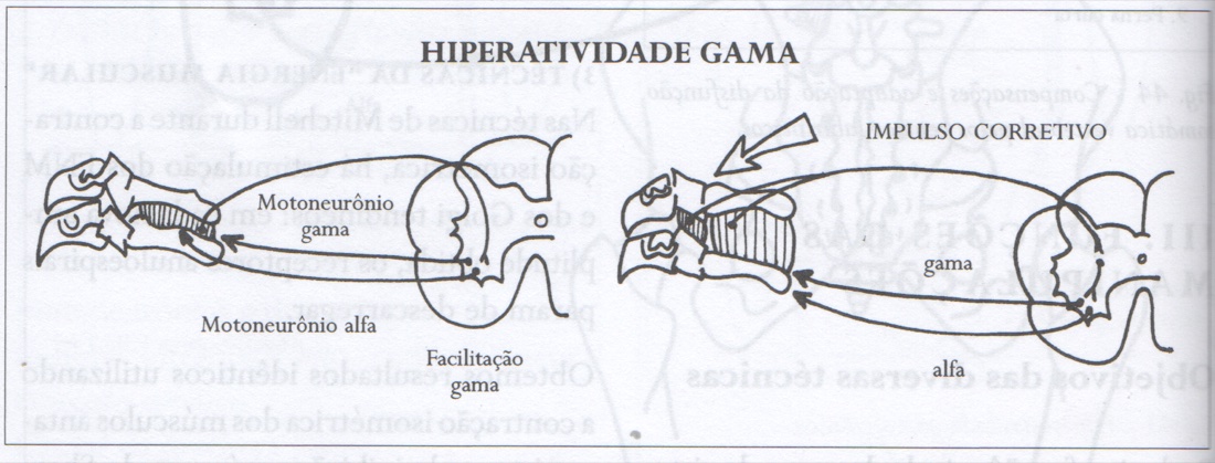 O padrão da correção. Na figura à esquerda, observa-se a hiperatividade gama. Na figura à direita, a resposta de normalização frente à intervenção do osteopata