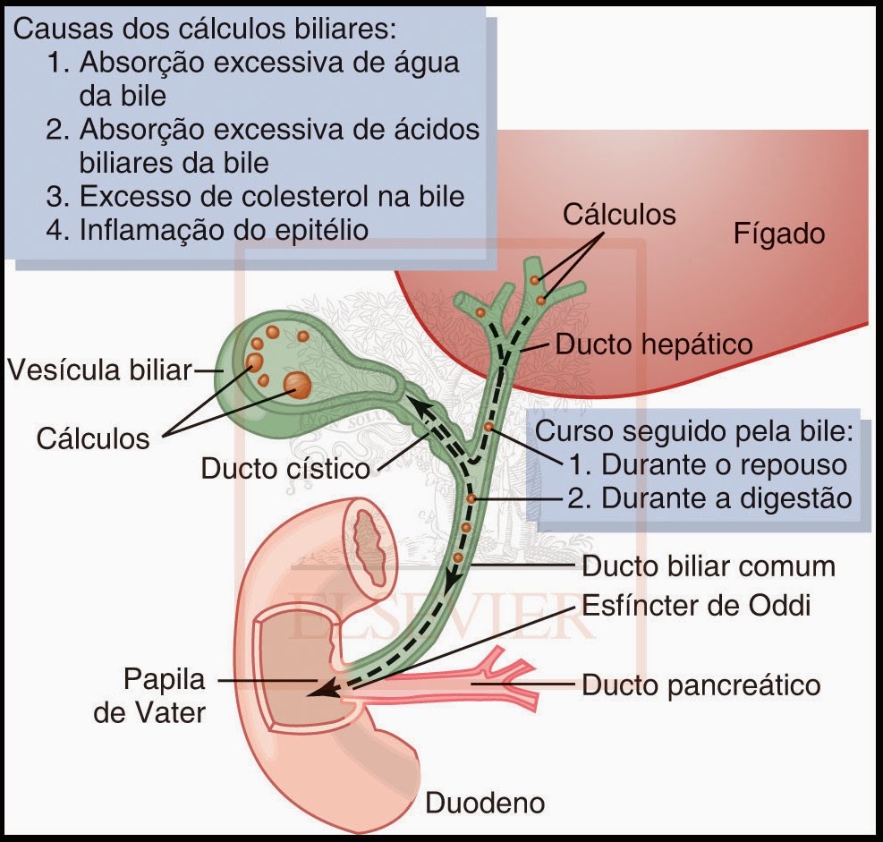Esquema da produção dos cálculos biliares.